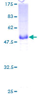 12.5% SDS-PAGE Stained with Coomassie Blue.